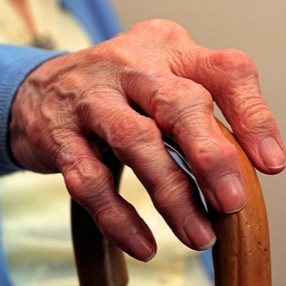 Ревматоидный артрит: что это такое и как с ним жить?