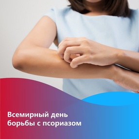 29 октября -  Всемирный день борьбы с псориазом